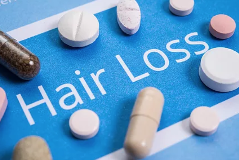 hair loss treatment Singapore