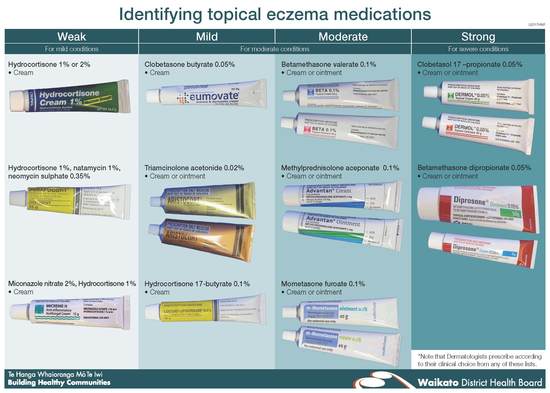 steroid cream eczema singapore