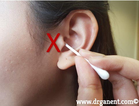 earwax singapore