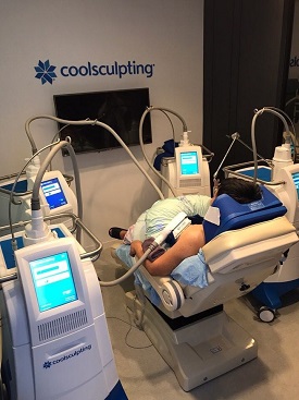 Coolsculpt Singapore