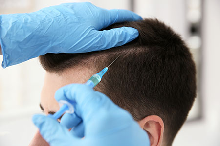 FUE hair transplant singapore