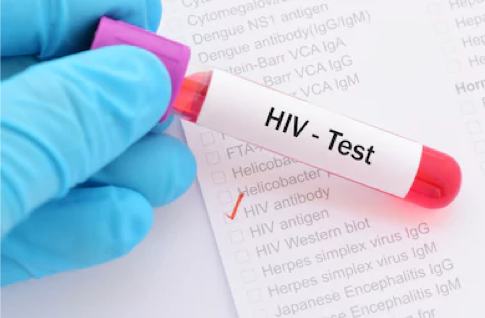 HIV testing in Singapore