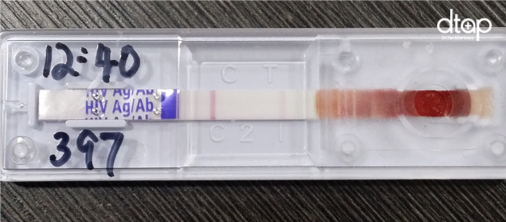 HIV test in Singapore