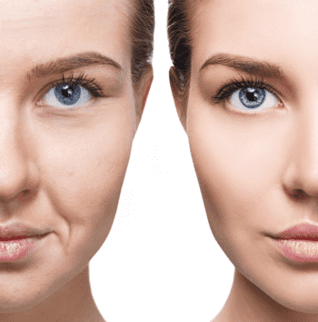 non-surgical facelift singapore