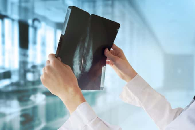 doctor looking at an xray against the light