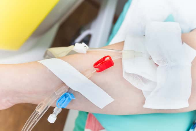 needle kidney dialysis singapore