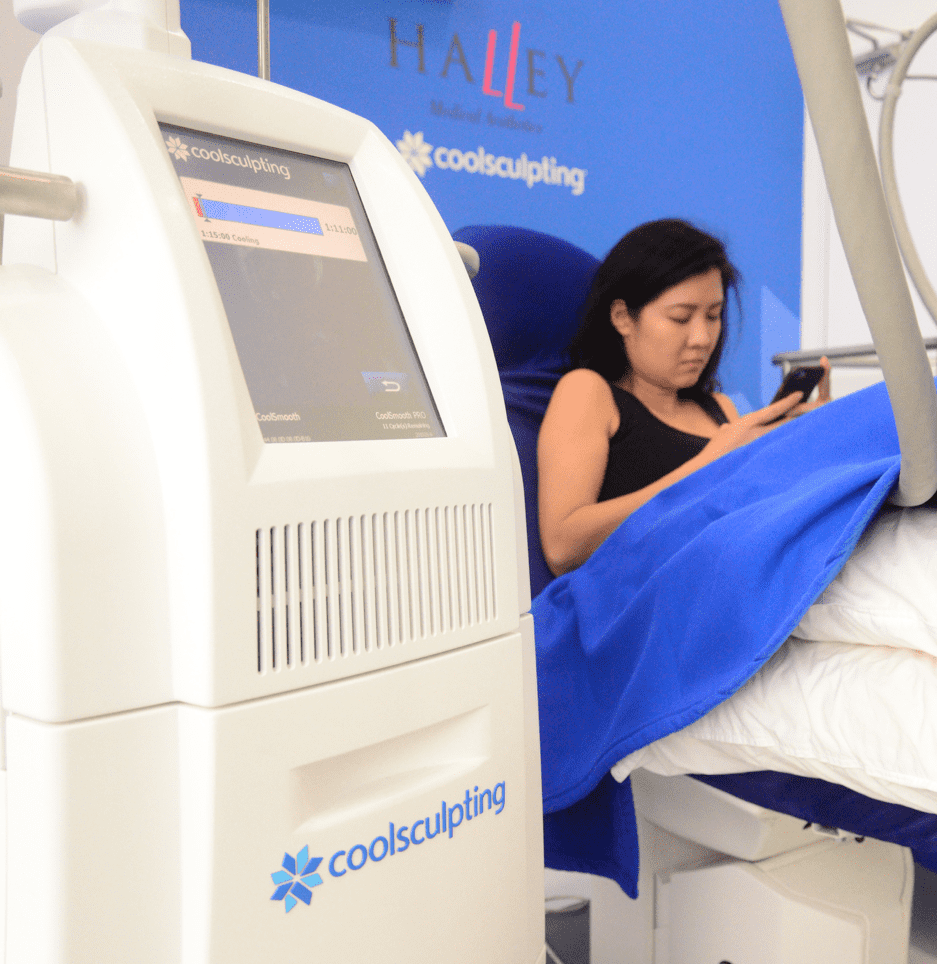 coolsculpt singapore 