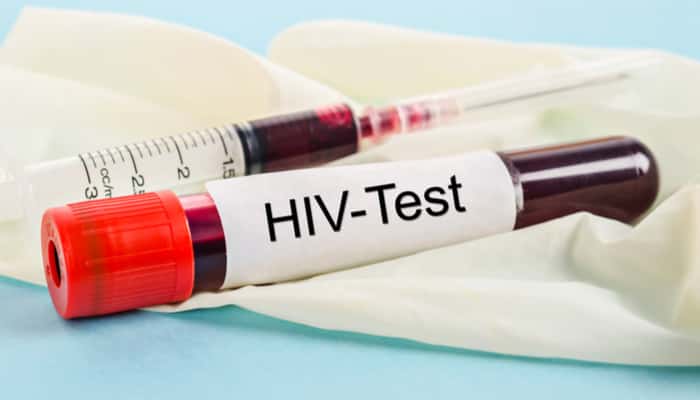 HIV testing singapore