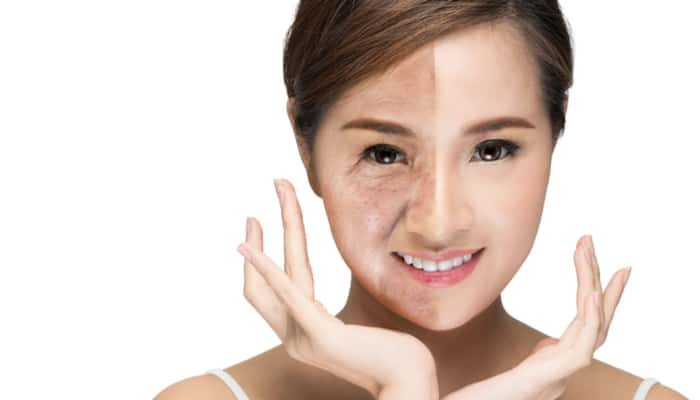 non surgical facelift for aging face