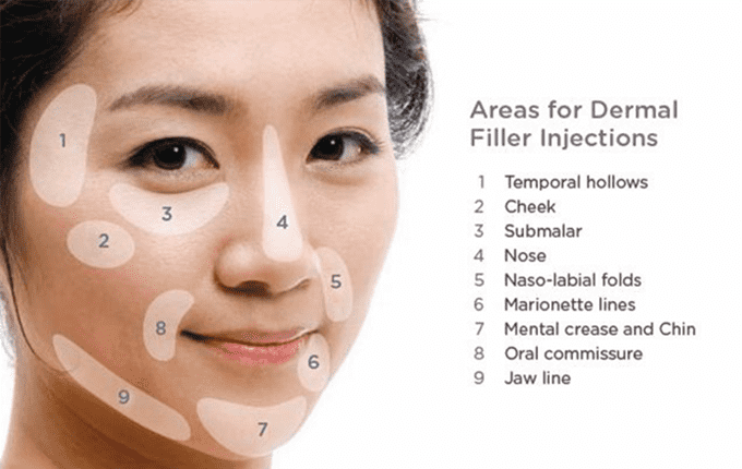 dermal fillers singapore