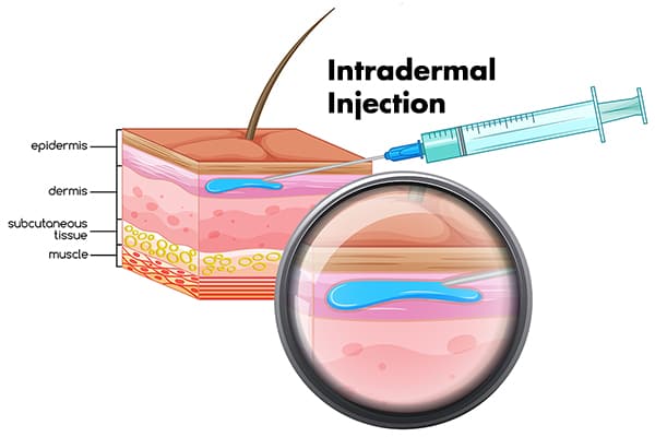 intradermal injection skinbooster and rejuran