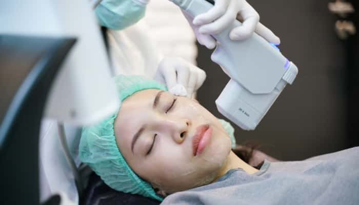 Laser or frequency Skin Tightening Face Lift treatment