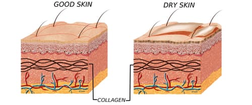 Dry skin vs good skin