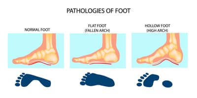 Feet infographic