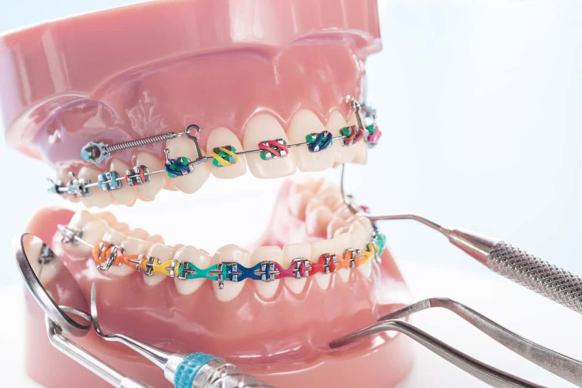 braces for jaw surgery singapore