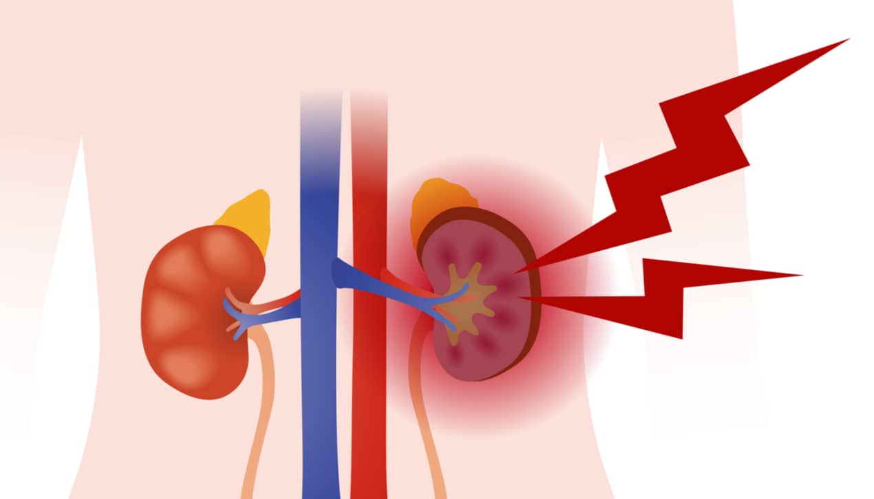 kidney failure from diabetes