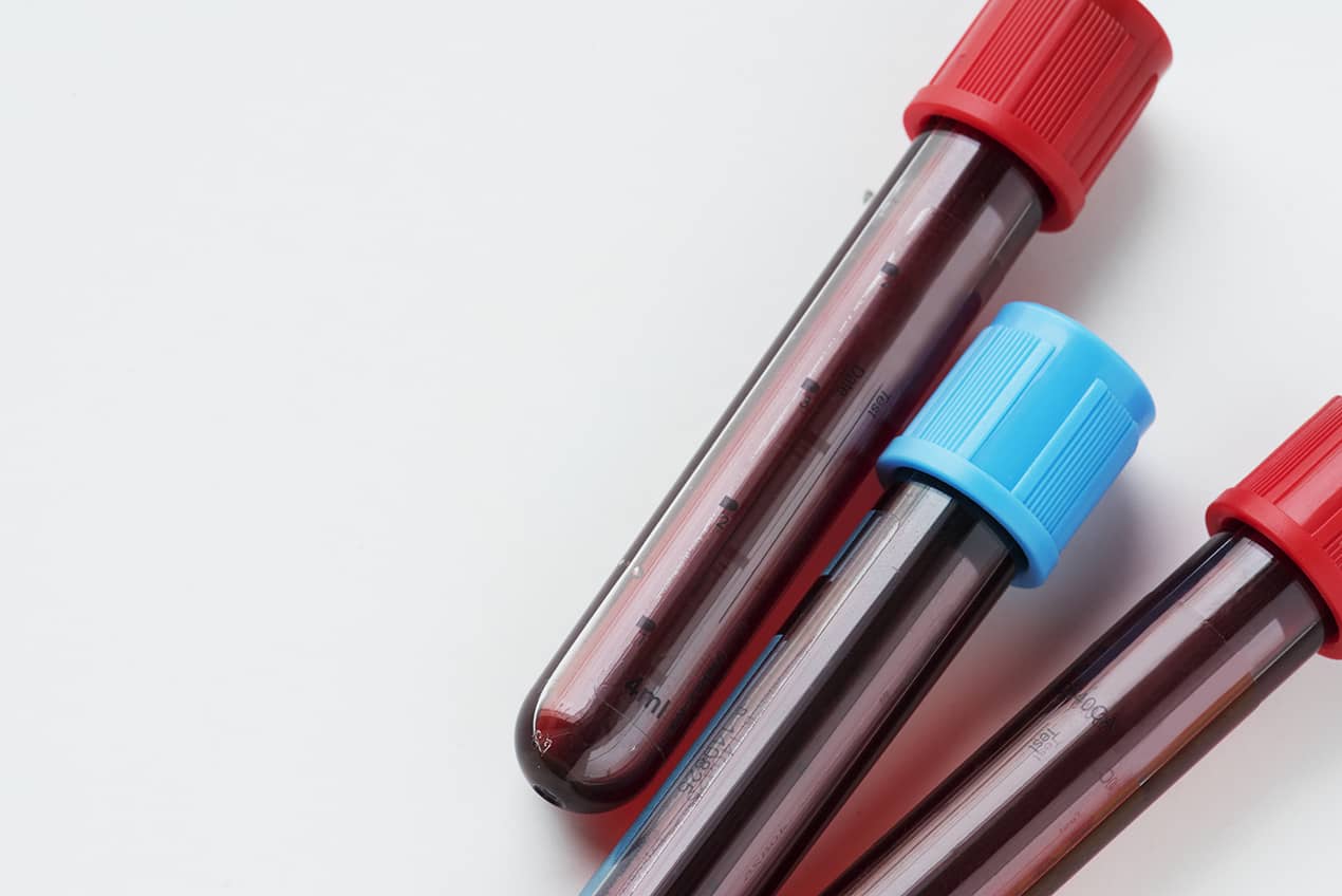 blood in test tubes