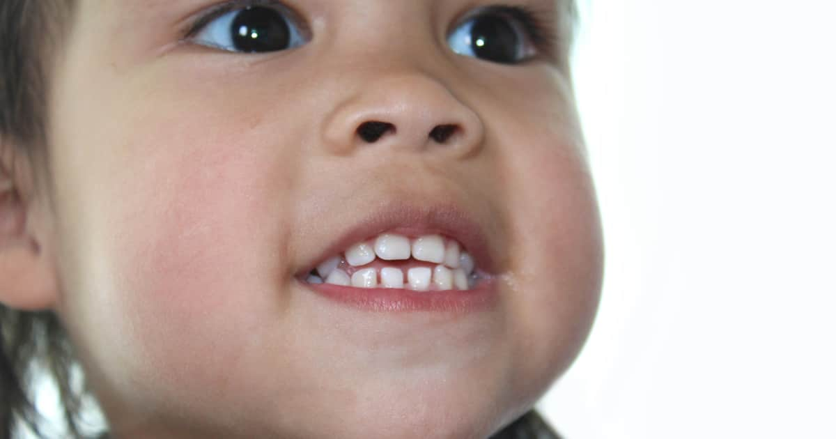 child showing her teeth and jaw