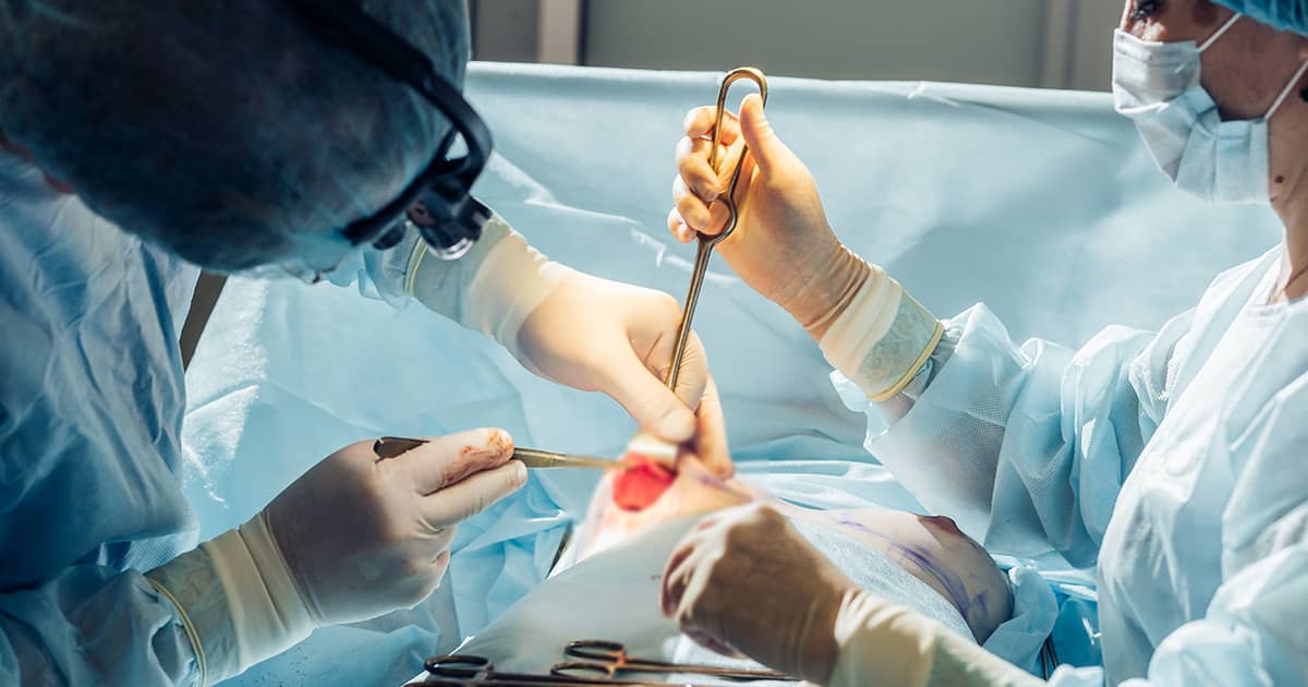 a breast surgery in progress, showing incision site blurred out