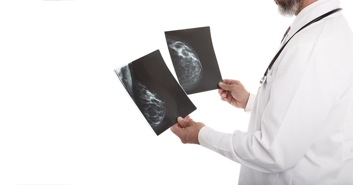 a doctor holding up breast x-rays