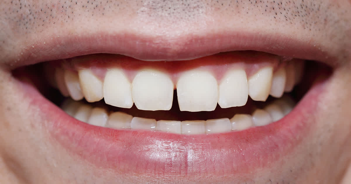 closeup of a man with a tooth gap