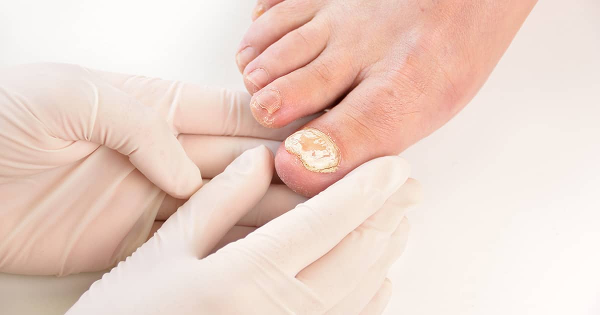 doctor checking a patient's toenail