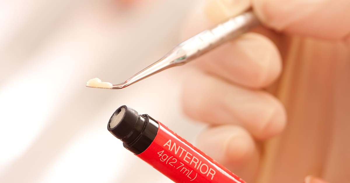 a dentist taking some resin filling from a container