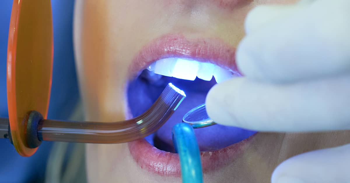 a woman having tooth whitening treatment