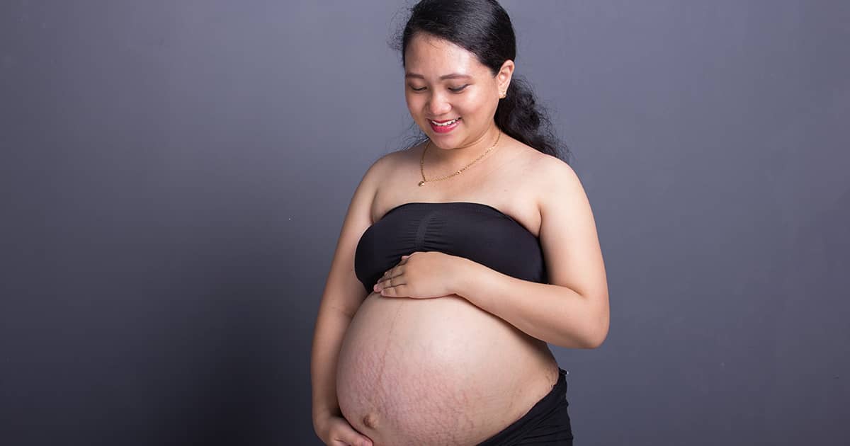 pregnant woman with stretch marks and line on tummy