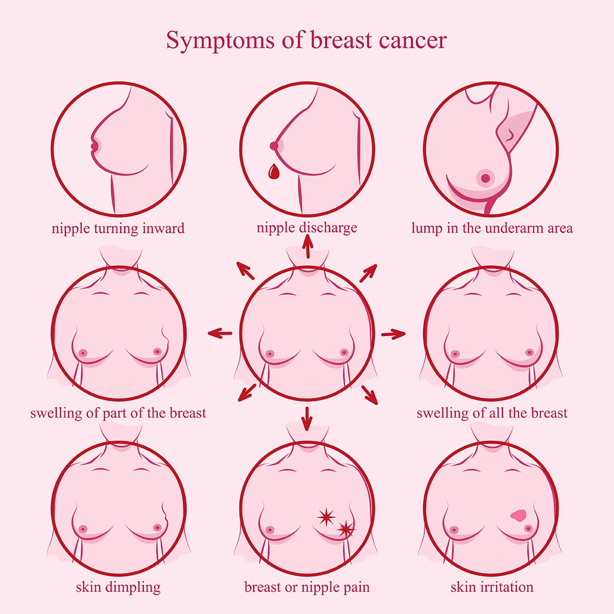 illustrated list of symptoms of breast cancer