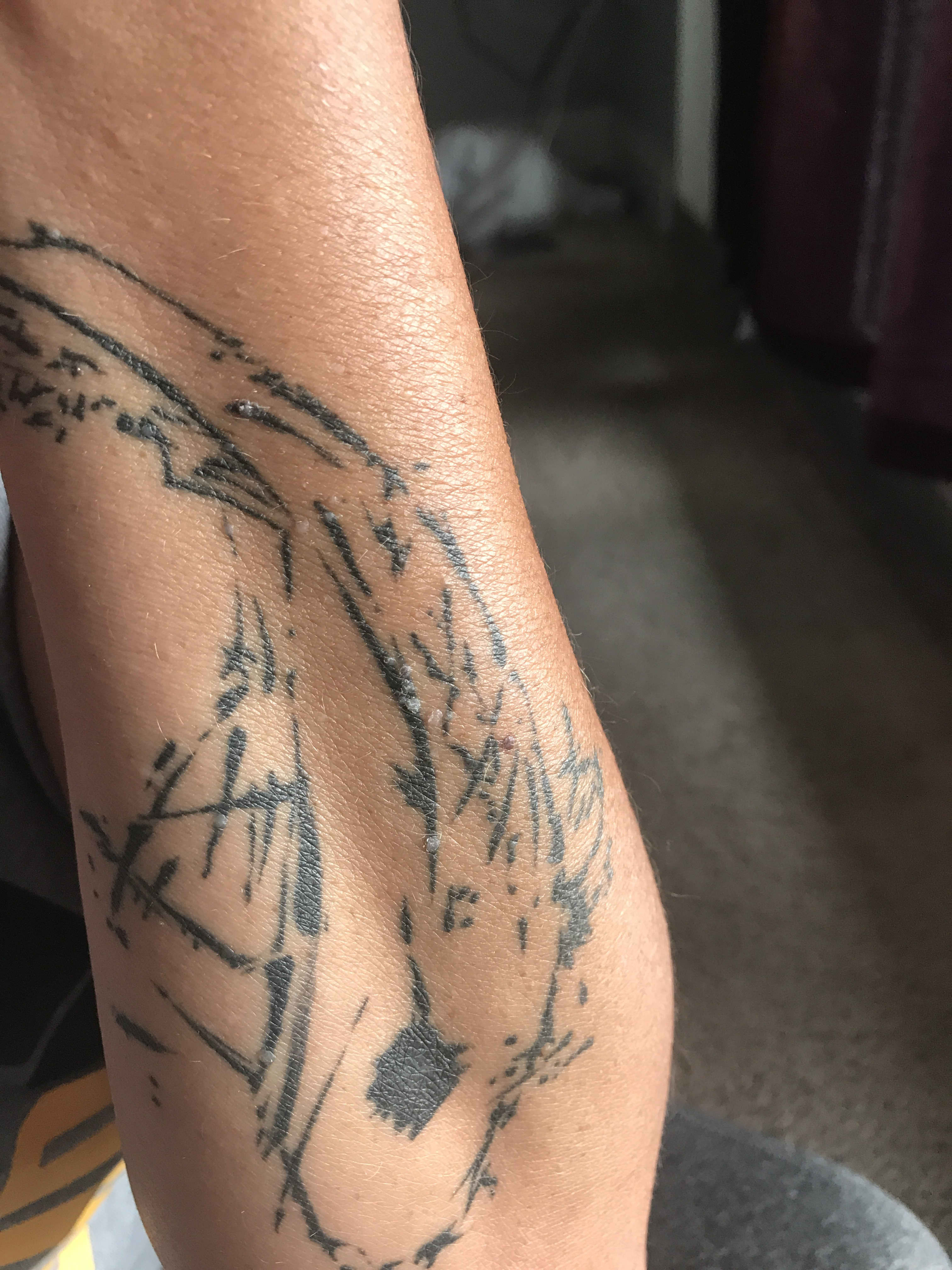 Black Tattoo Healing And Turning Grey  Heres Why  AuthorityTattoo