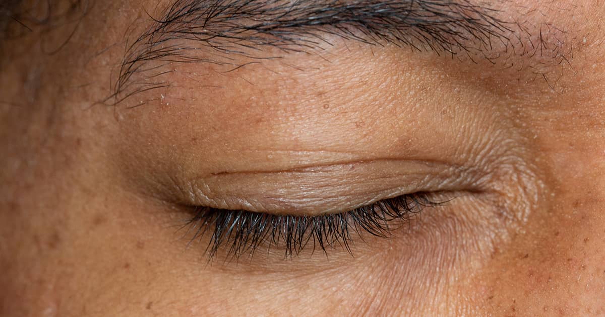 a closed eye with wrinkles