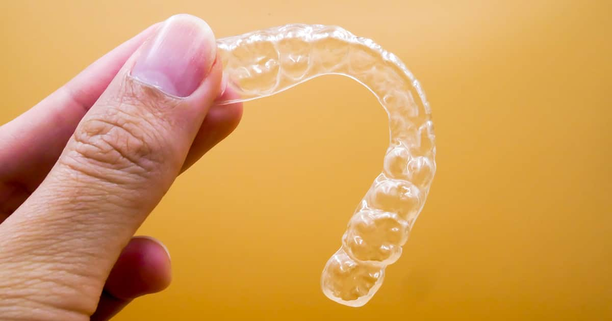 clear dental aligners