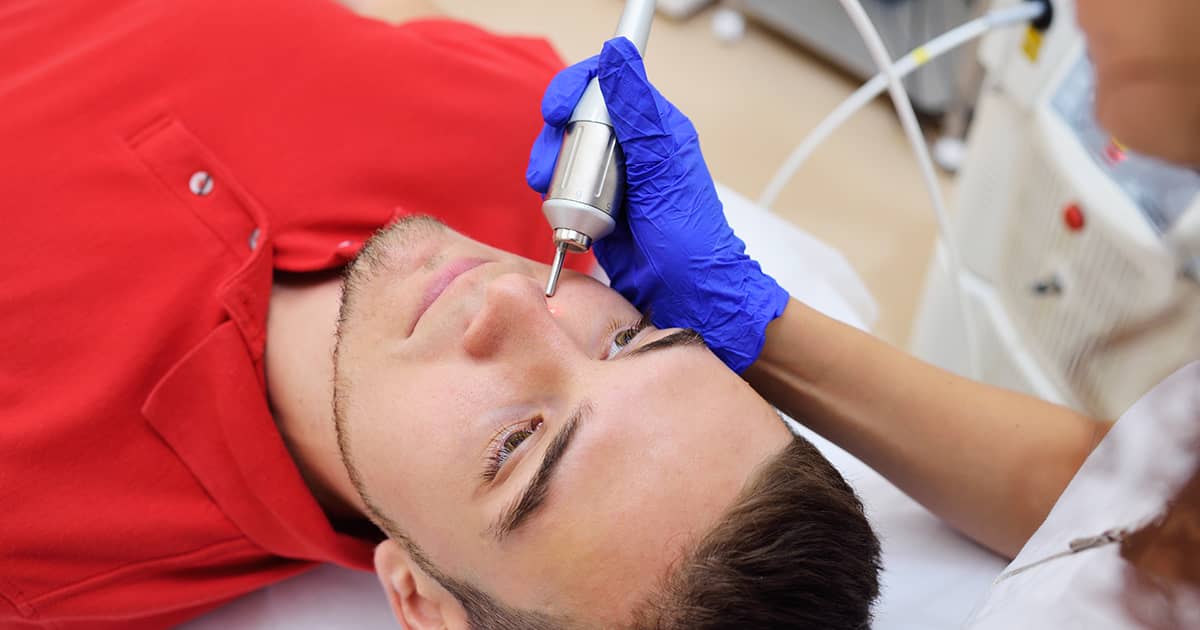 a man receiving laser treatment on his face