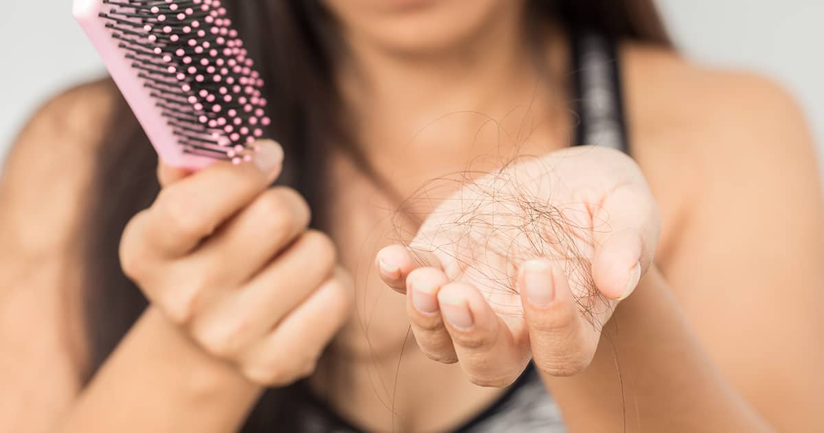 woman with hair loss