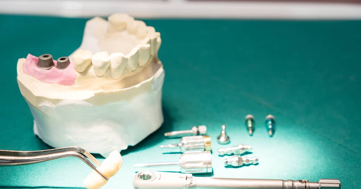 a dental implant model