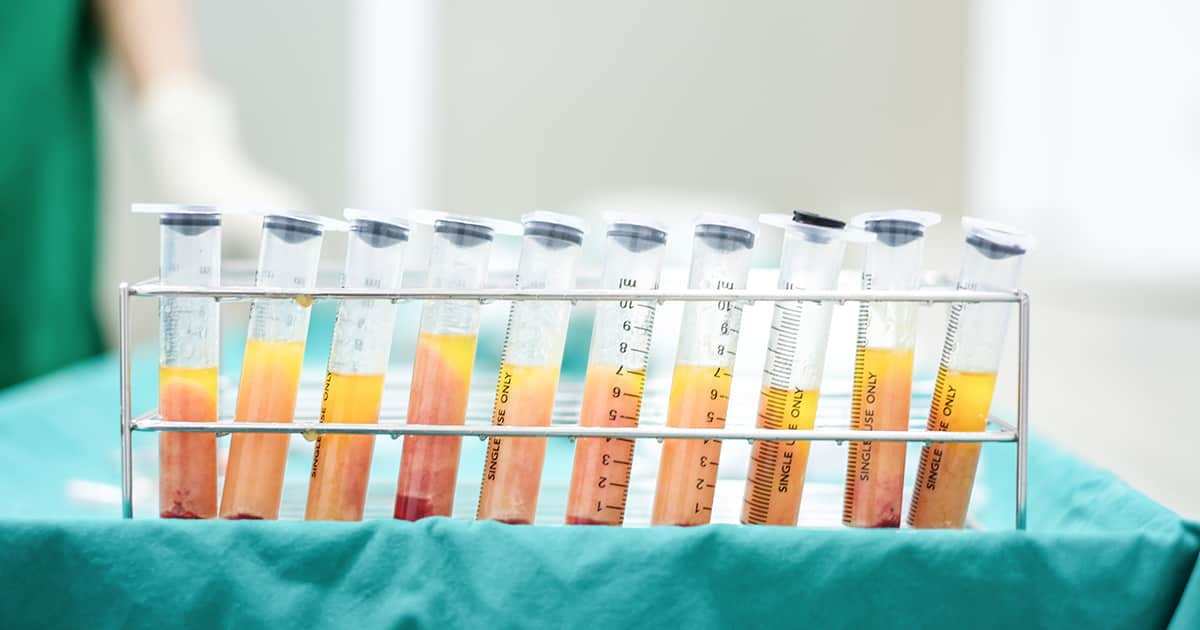 a row of syringes in operating theatre