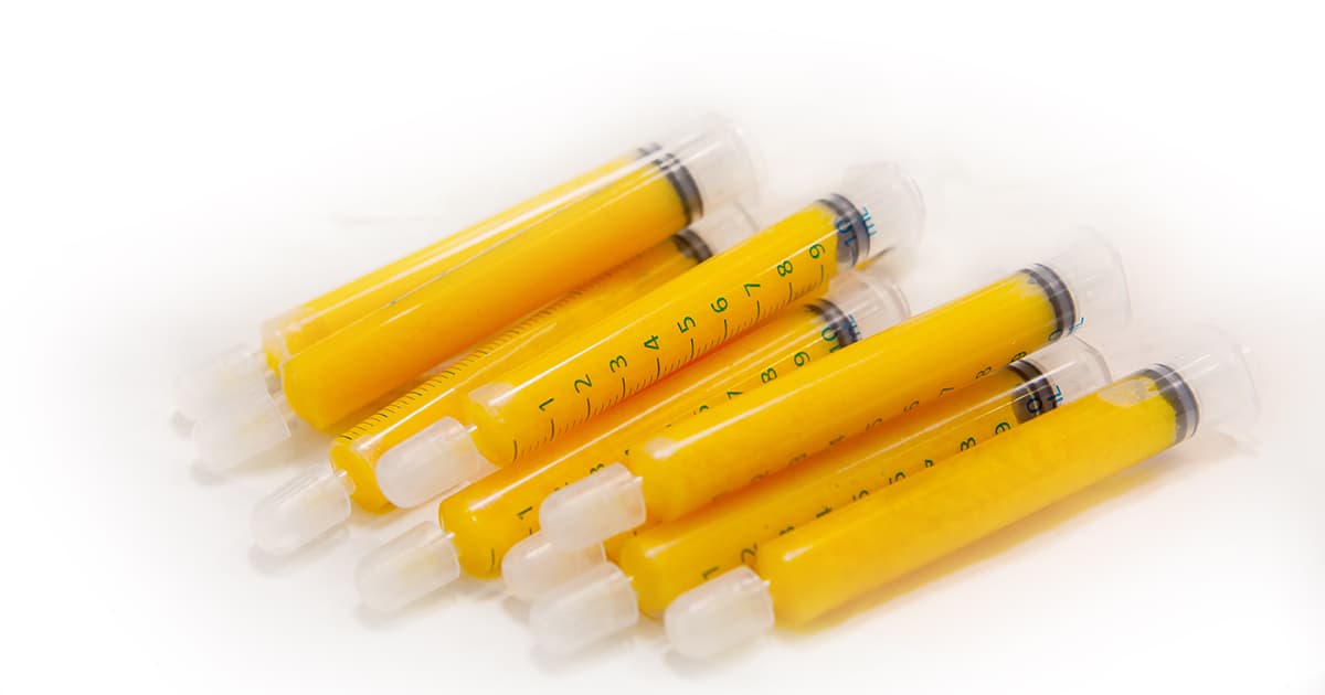 syringes of human fat on table