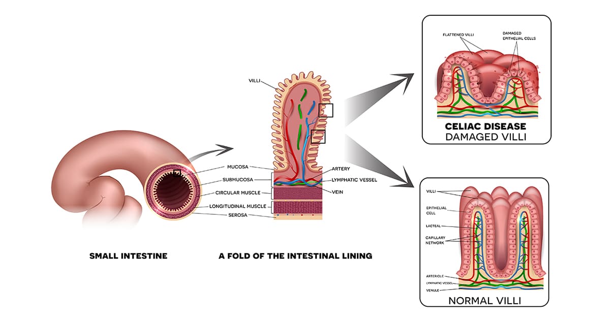 illustration of a small intestine and villi