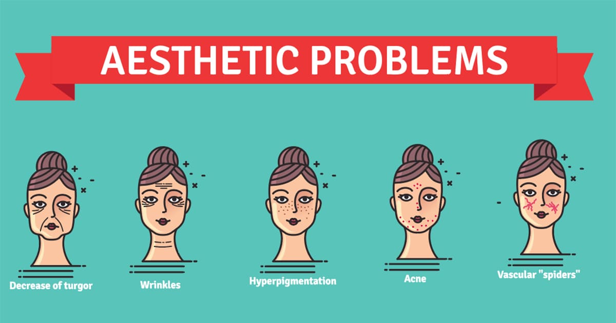 illustration of aesthetic problems for laser treatment