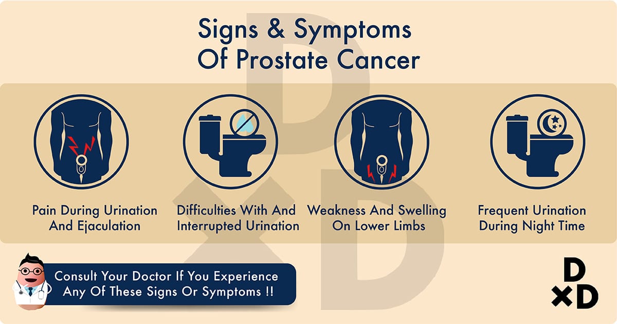 illustration on the signs and symptoms of prostate cancer