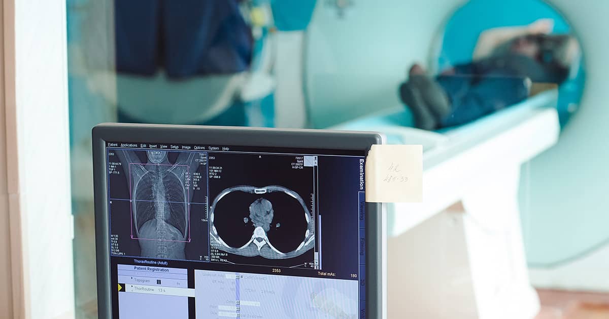 man receiving radiotherapy