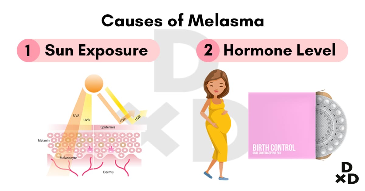 causes-melasa-illustration