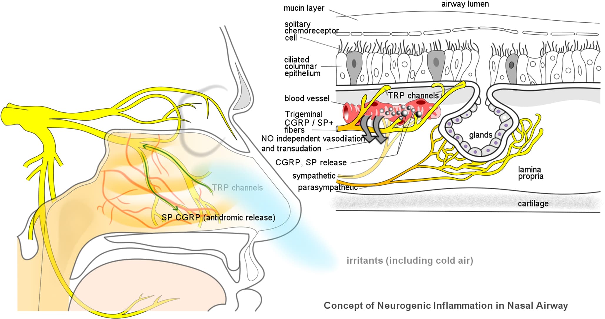 Non-allergic rhinitis