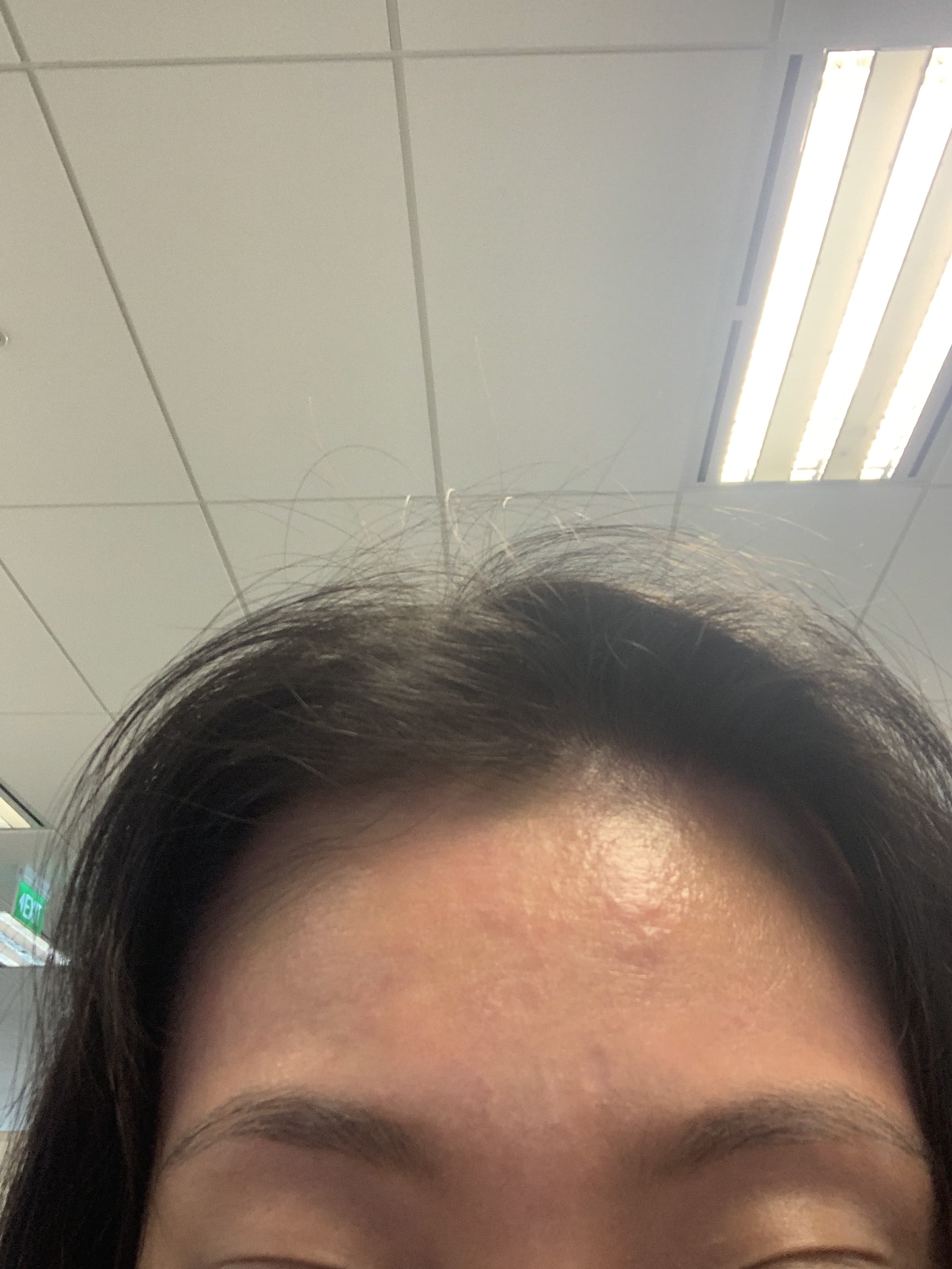 How does cosmetics aggravate skin conditions like contact and atopic dermatitis, eczema or run-off pattern? - human How does cosmetics aggravate skin conditions like contact and atopic dermatitis, eczema or run-off pattern? - human