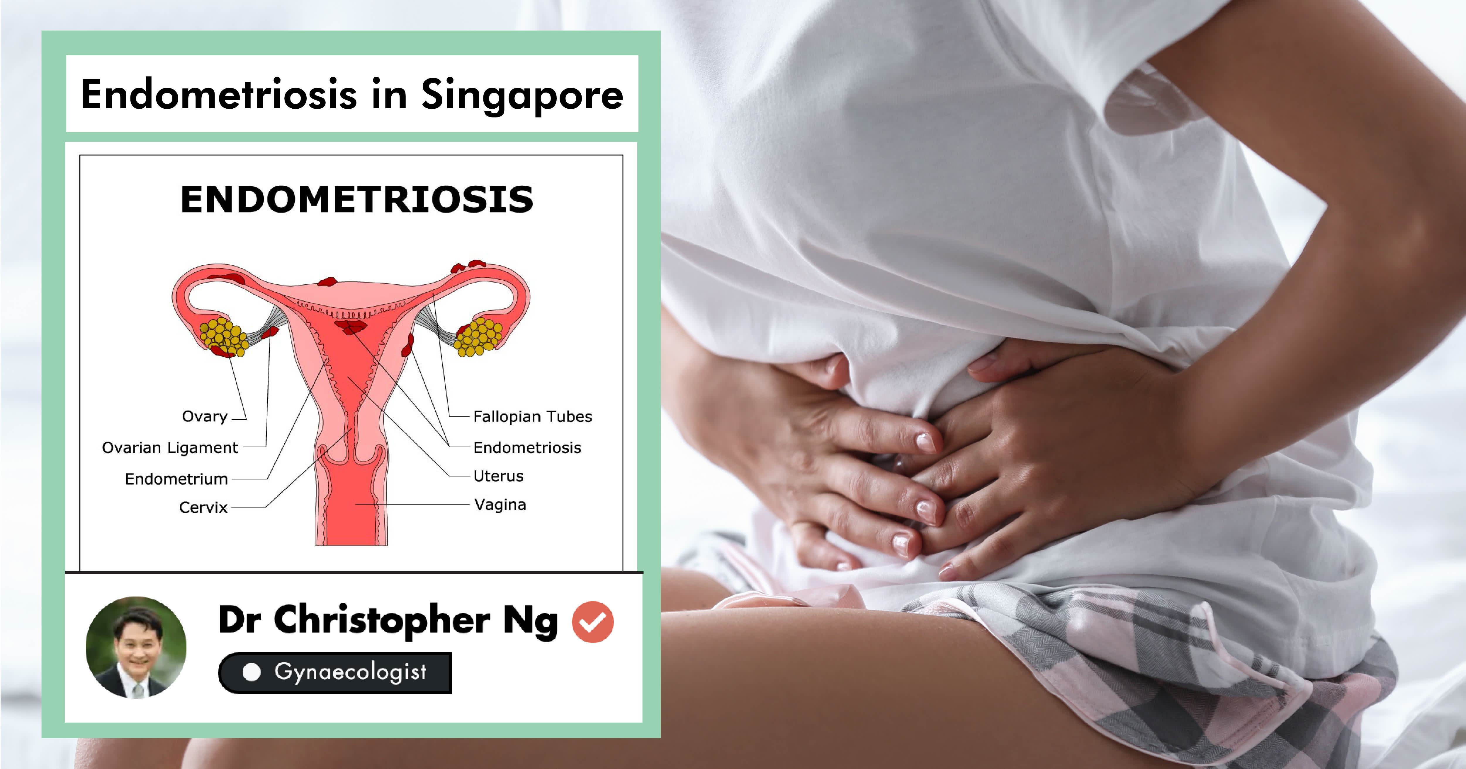 Panduan Lengkap Mengenai Penanganan Endometriosis Di Singapura 2019