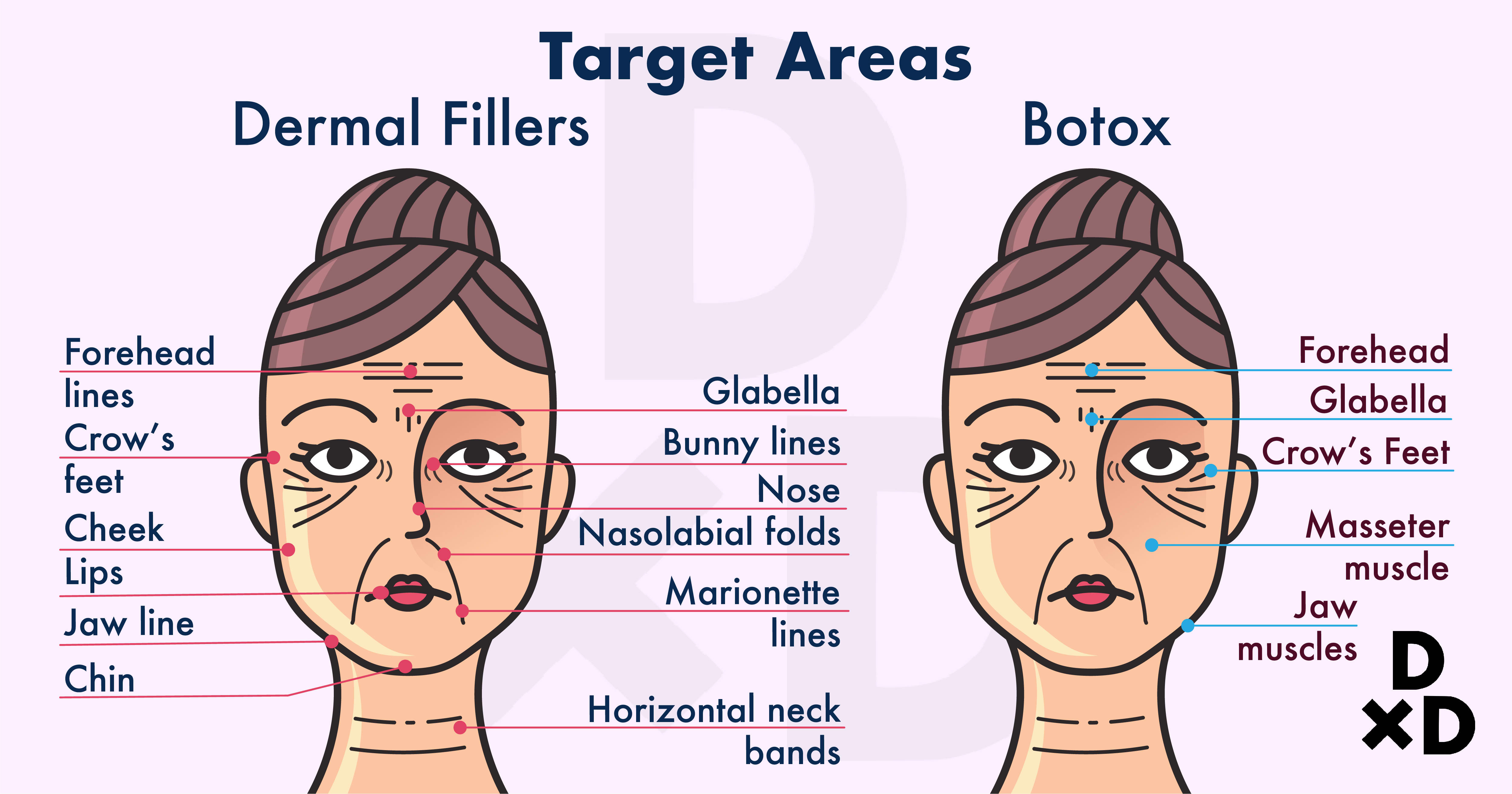 botox-vs-filler_target-of-fillers-and-botox