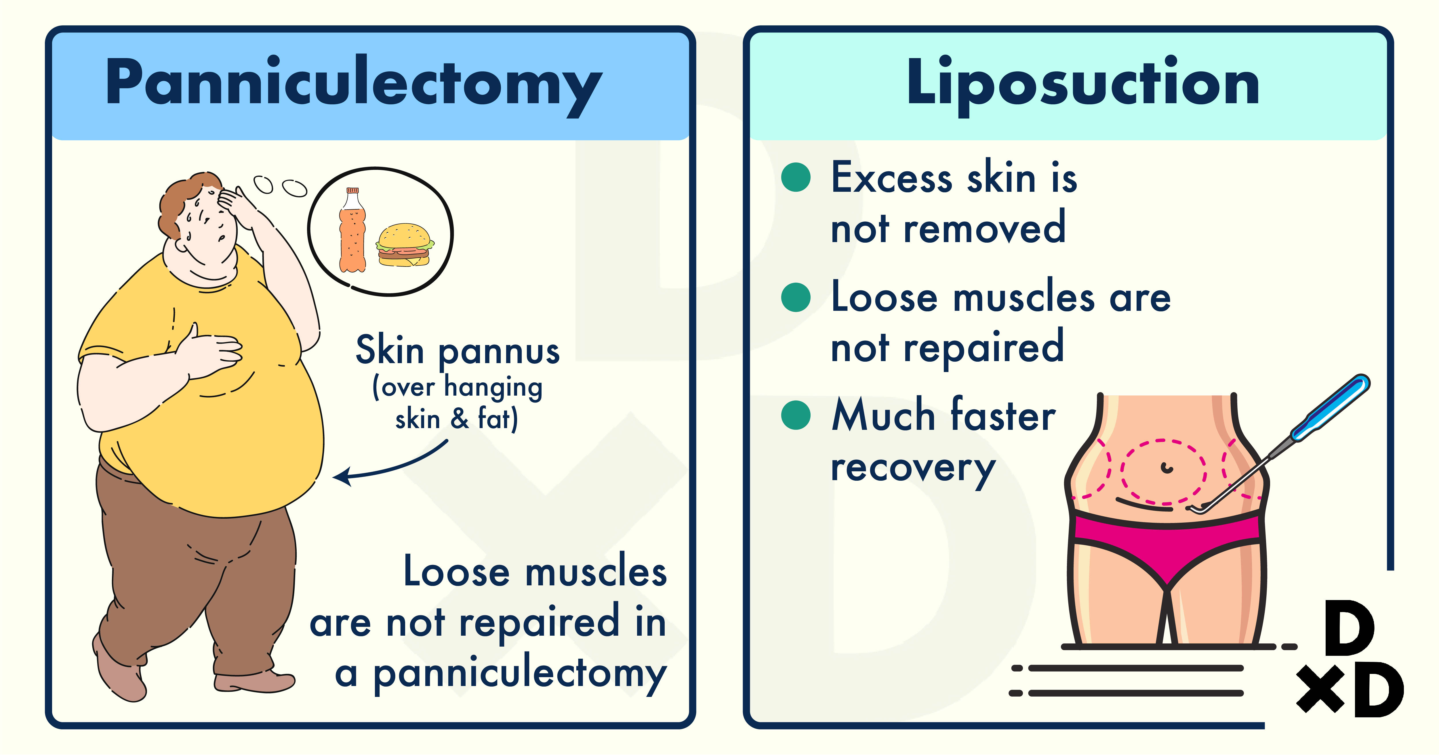 abdominoplasty-panniculectomy-and-liposuction