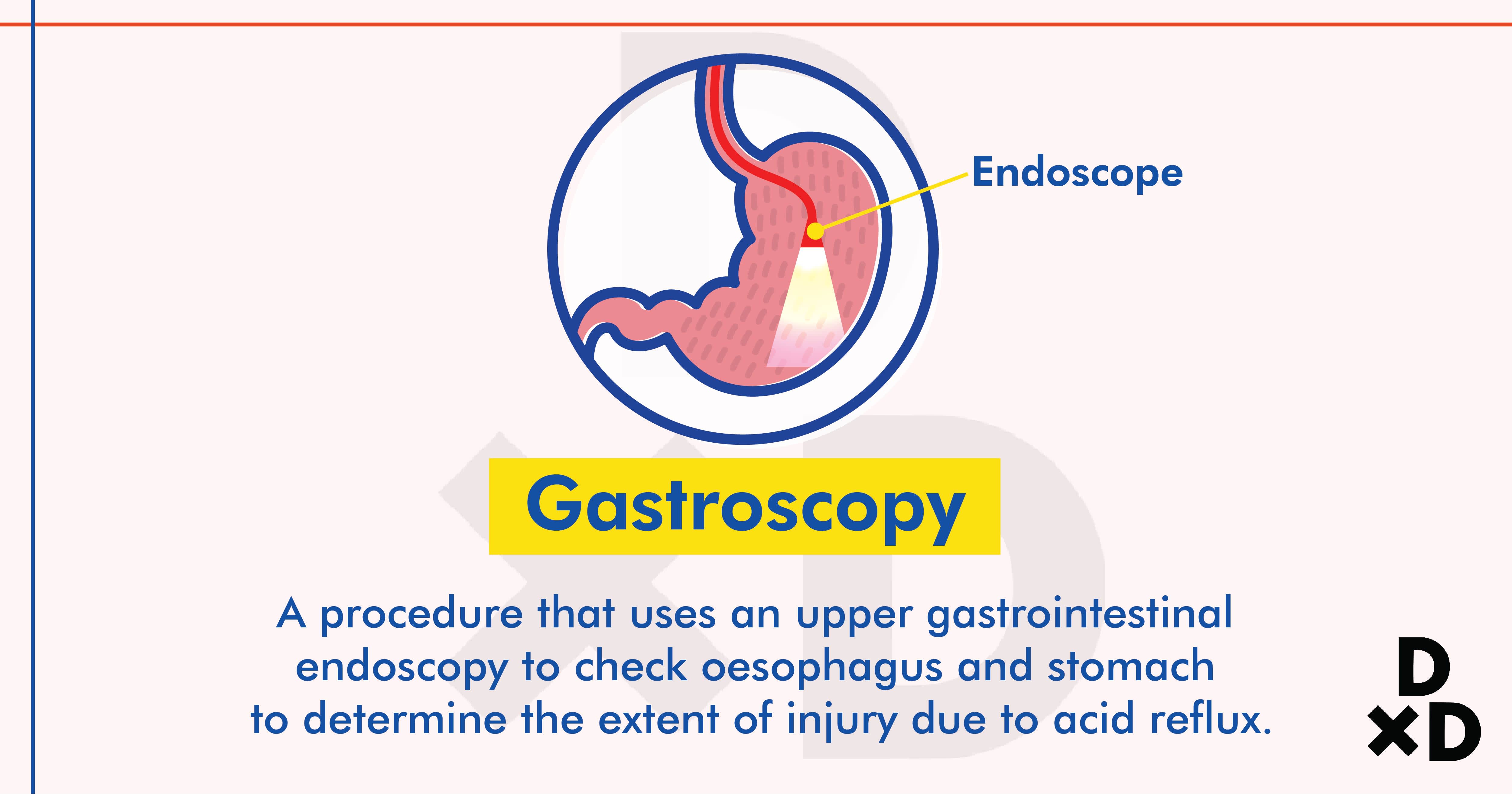 gastroscopy