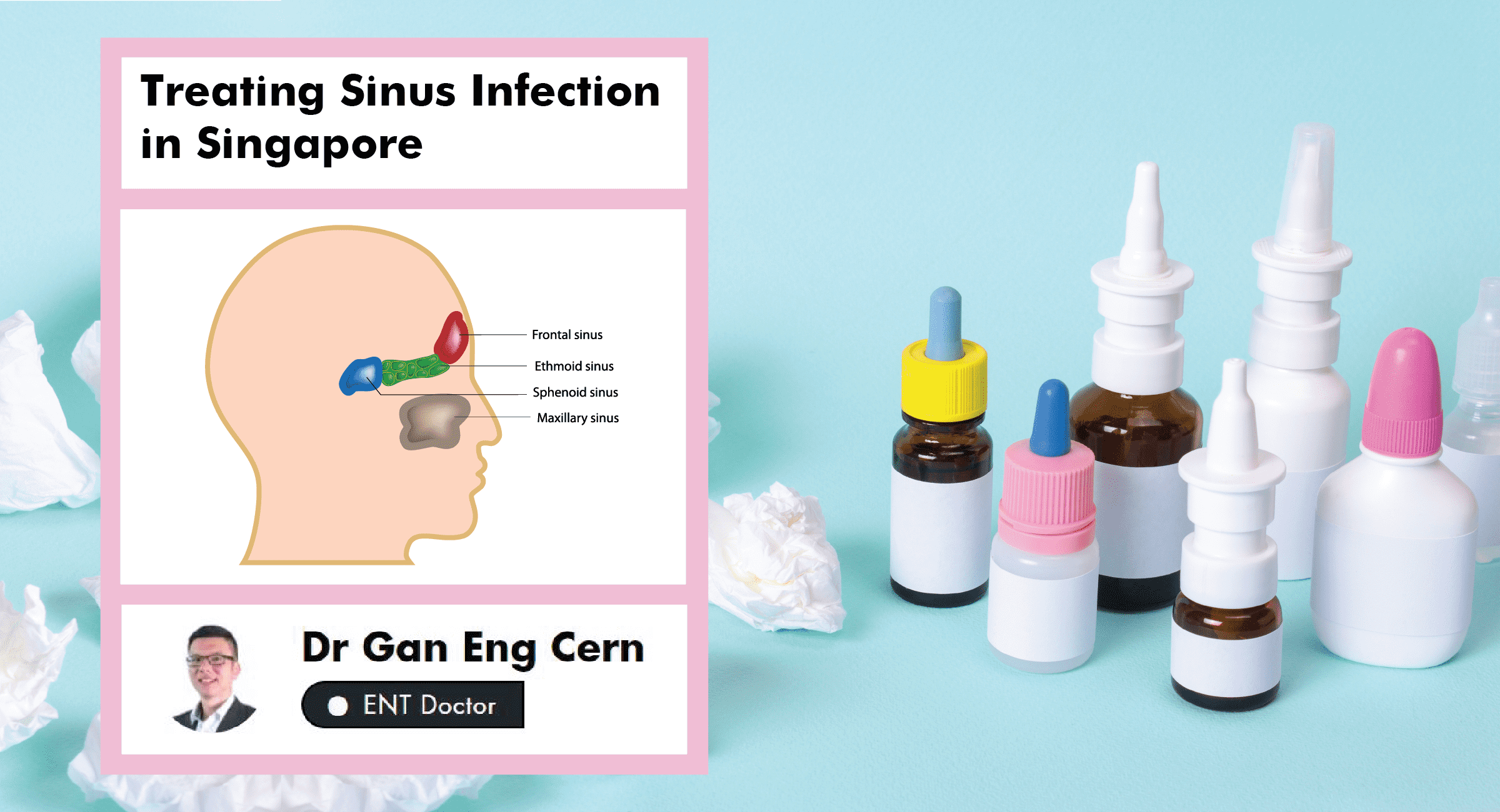 A Complete Guide To Sinus Treatment In Singapore 21